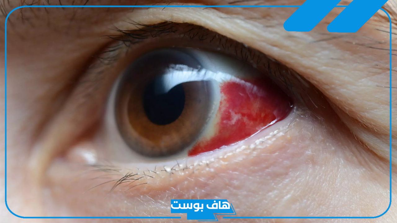 تفسير حلم العين المصابة في المنام للرجل والمرأة