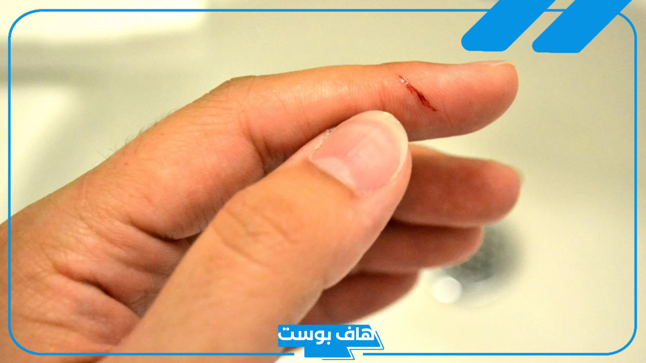 تفسير حلم قطع الاصبع في المنام للرجل والمرأة المتزوجة بدون دم
