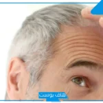تفسير حلم الشعر الابيض في المنام للرجل والمرأة المتزوجة لابن سيرين