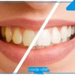 تفسير حلم تنظيف الاسنان في المنام للمرأة والرجل بالفرشاة والمعجون