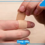 تفسير حلم الجرح في اليد اليسرى واليمنى للرجل والمرأة لابن سيرين