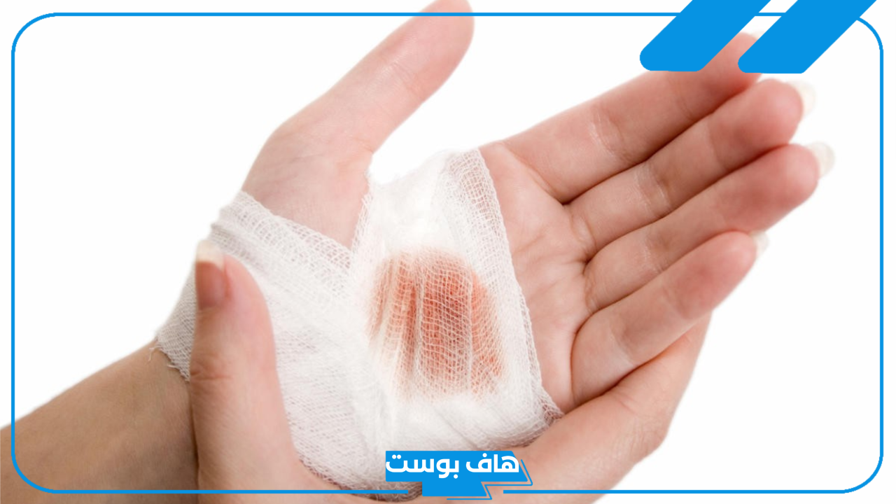 تفسير حلم الجرح في اليد اليسرى واليمنى للرجل والمرأة لابن سيرين