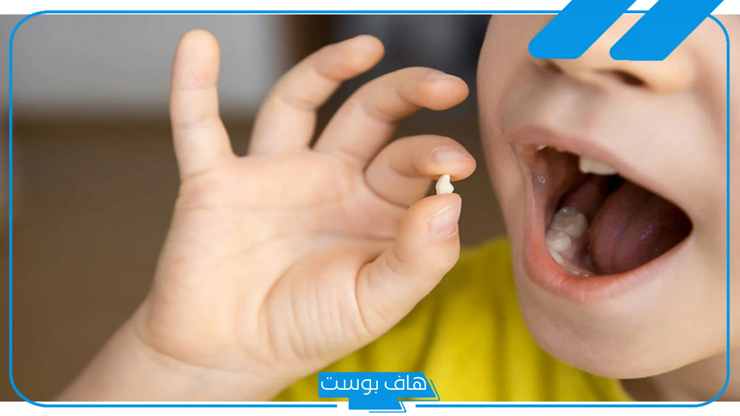 تفسير رؤية سقوط الضرس في المنام بدون دم وألم لابن سيرين