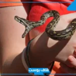 تفسير حلم لدغة الثعبان في اليد في المنام للرجل والمرأة