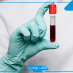 تفسير حلم الدم في اليد اليمنى واليسرى للمرأة لابن سيرين