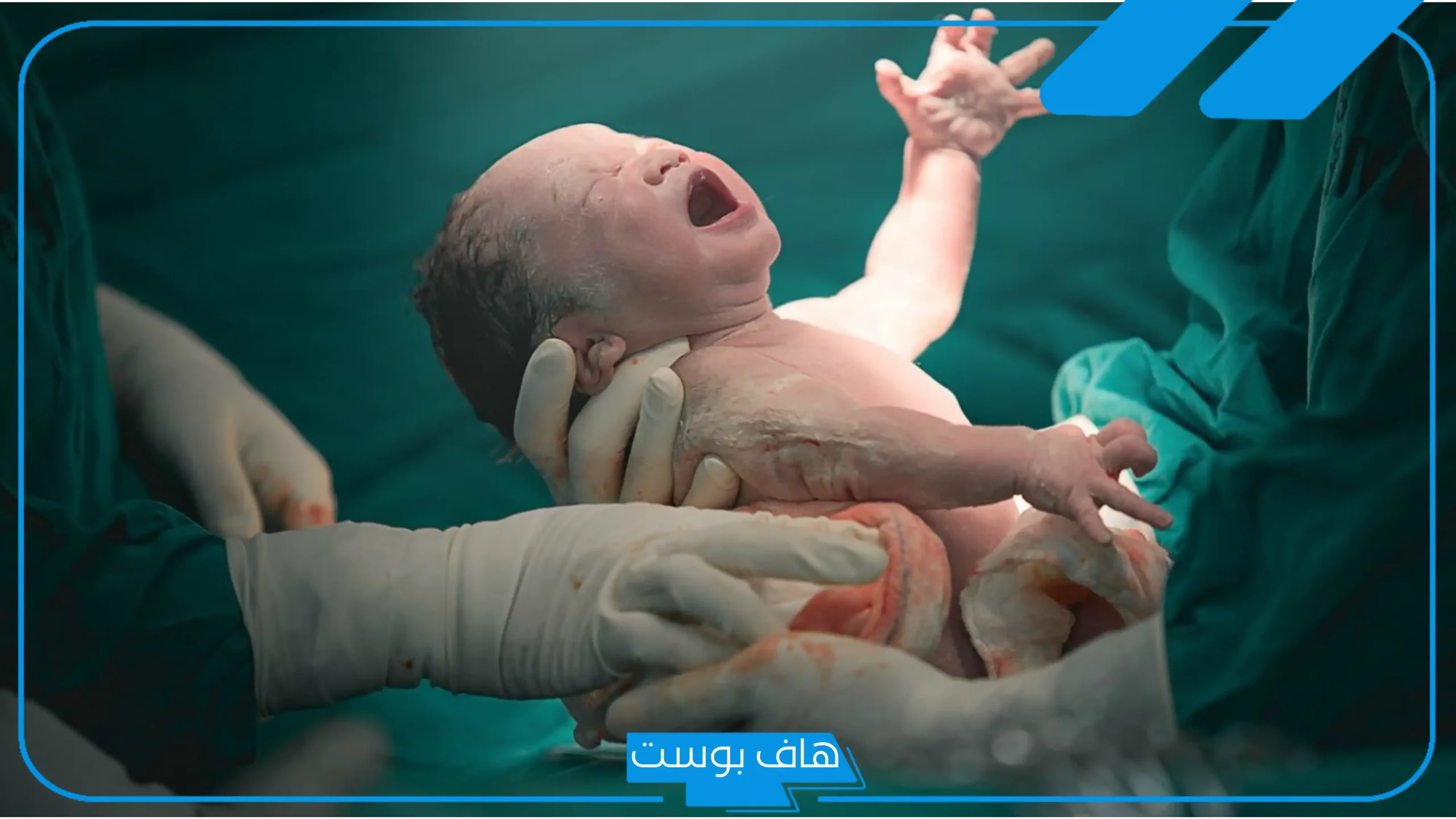 تفسير حلم الولاده بولد بدون الم للحامل والمتزوجة والعزباء لابن سيرين