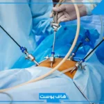تفسير حلم عملية جراحية في البطن في المنام للحامل والعزباء لابن سيرين 
