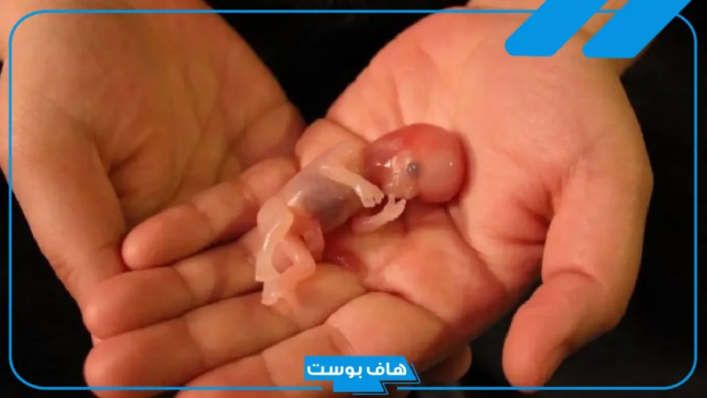 تفسير حلمت اني اجهضت وانا حامل في المنام لابن سيرين