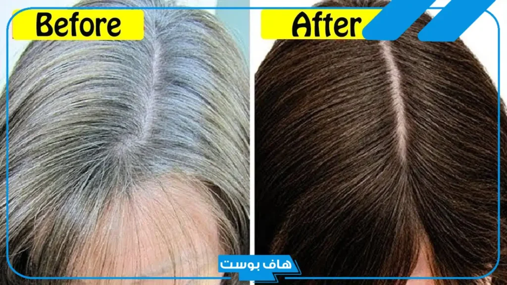 خلطة للشيب مجربة فعالة.. علاج شيب الشعر نهائيا وللأبد في اقل من ساعة