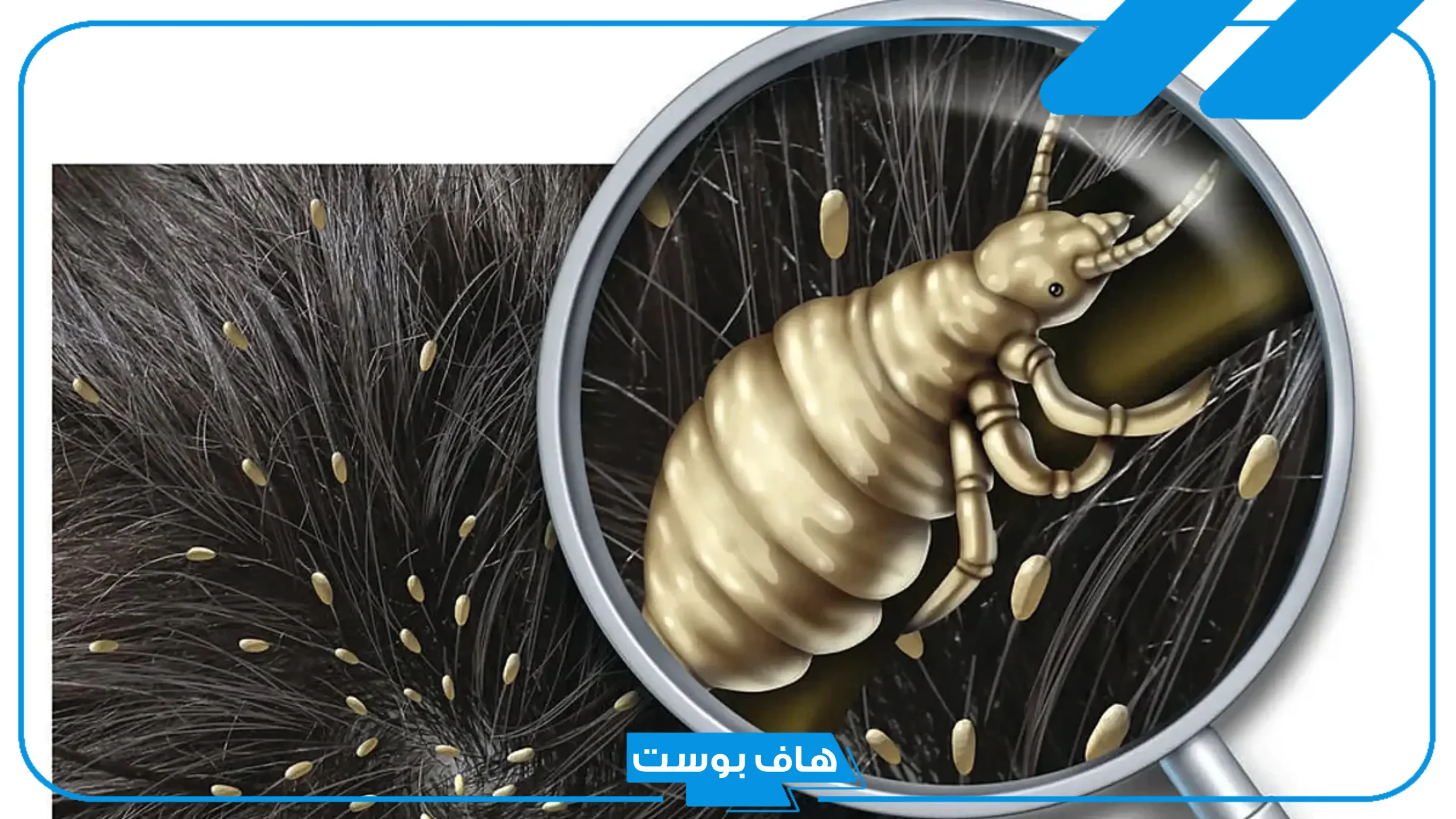 تفسير رؤية القمل في المنام لابن سيرين للعزباء والمتزوجة