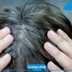 خلطة للشيب مجربة فعالة.. علاج شيب الشعر نهائيا وللأبد في اقل من ساعة