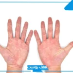 تفسير رؤية كف اليد في المنام للمتزوجة والعزباء والرجل لابن سيرين