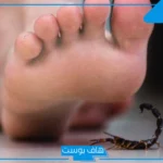 تفسير حلم القرص في المنام للرجل والمرأة في اليد اليسرى واليمنى لابن سيرين