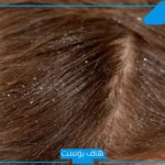 تفسير حلم الصيبان في الشعر وقتله للمتزوجة والمطلقة والعزباء