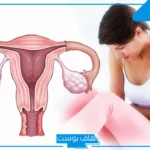 تفسير حلم خروج شي من الفرج للمطلقة والمتزوجة في المنام