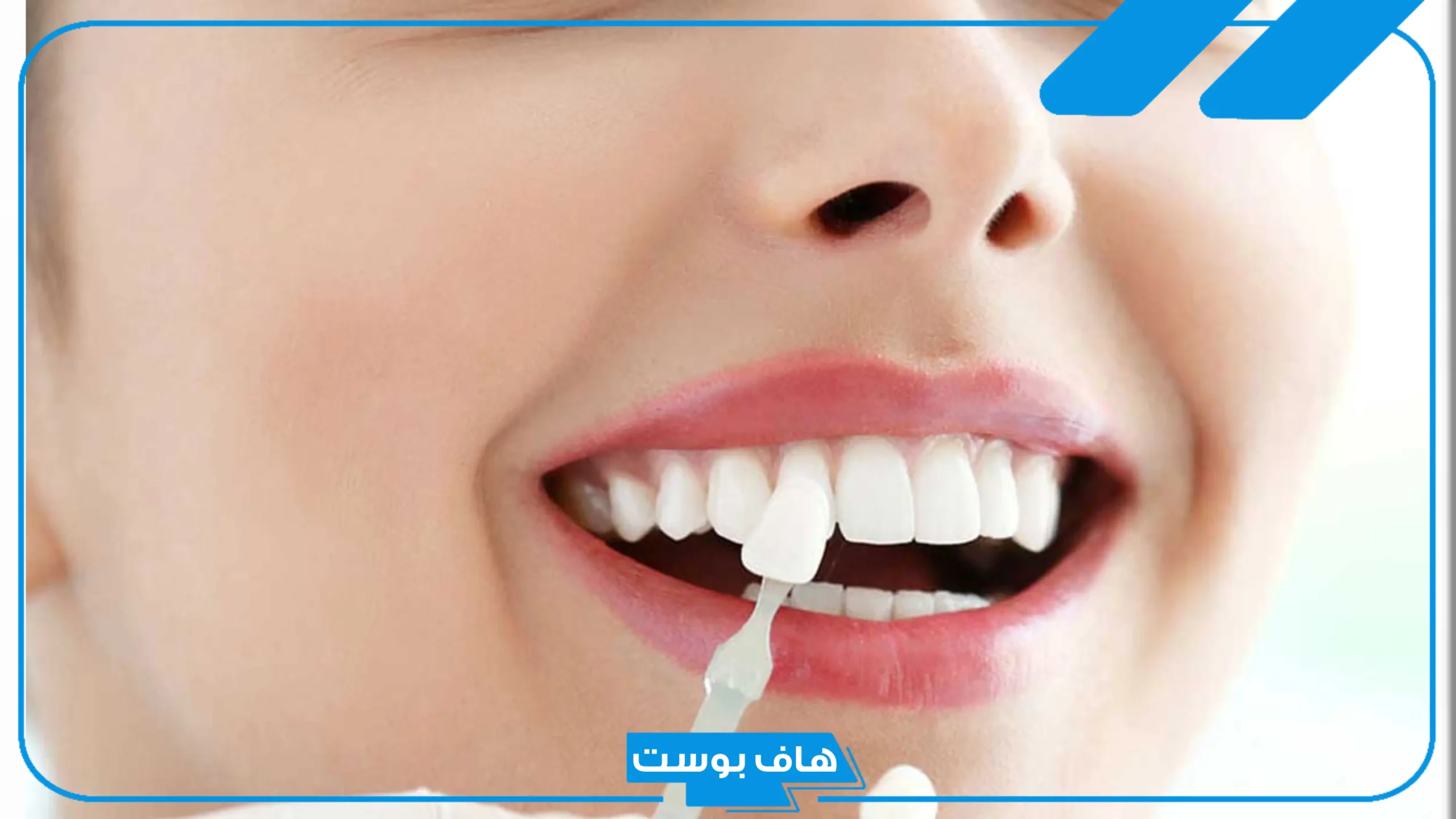 تفسير حلم تكسر الاسنان من السن العلوي في المنام لابن سيرين