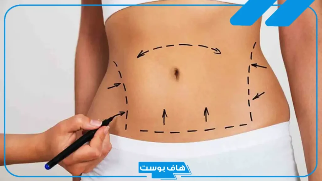 تفسير رؤية البطن في المنام لابن سيرين للمرأة العزباء والمتزوجة