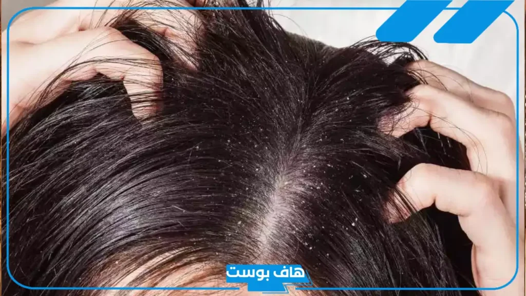 تفسير رؤية الصيبان في المنام للمطلقة والحامل والعزباء لابن سيرين