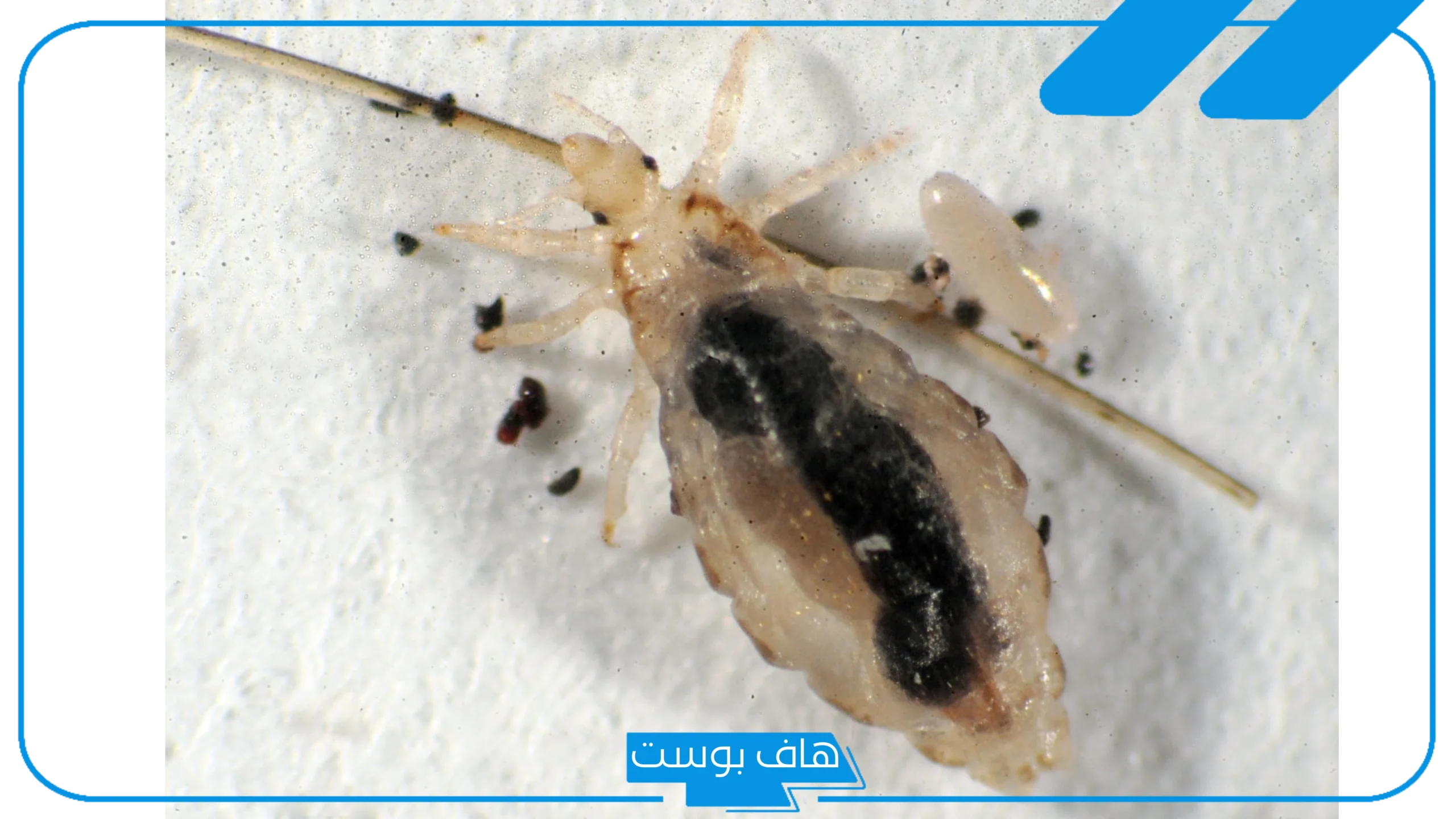 تفسير حلم القمل في شعر بنتي للحامل والمتزوجة لابن سيرين