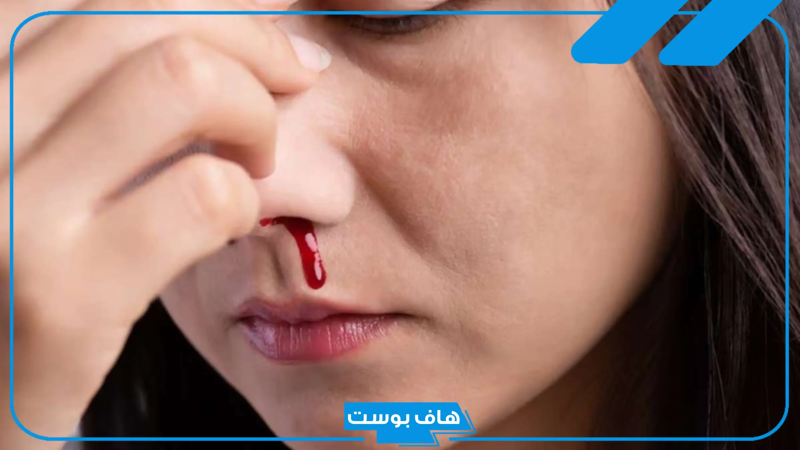 تفسير حلم خروج الدم من الانف في المنام والفم للمتزوجة لابن سيرين