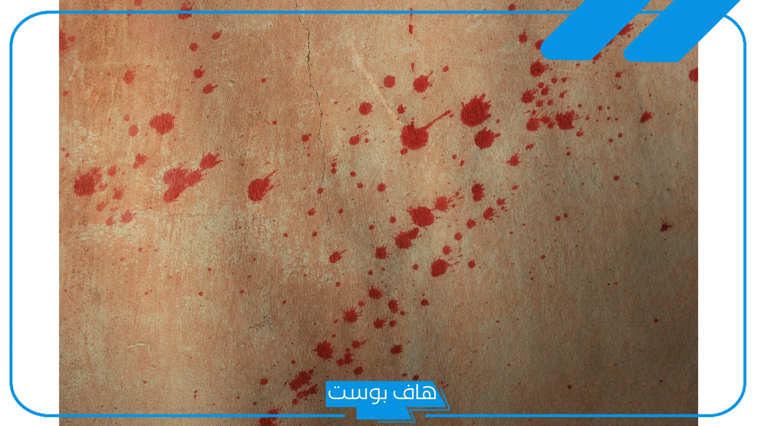 تفسير خروج الدم من الفرج في المنام للعزباء والمتزوجة للعالم ابن سيرين