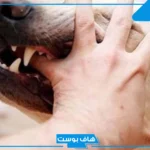 تفسير حلم كلب يعضني في اليد اليمنى وخروج الدم لابن سيرين في المنام
