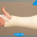 تفسير حلم كسر اليد للمتزوجة في المنام وكسرها لشخص آخر لابن سيرين