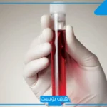 تفسير خروج الدم من الفرج في المنام للعزباء والمتزوجة للعالم ابن سيرين