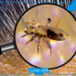 تفسير حلم القمل في شعر بنتي للحامل والمتزوجة لابن سيرين