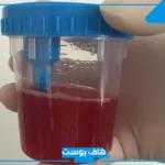 حلمت اني اتبول دم في المنام للعزباء والرجل والمرأة المتزوجة لابن سيرين