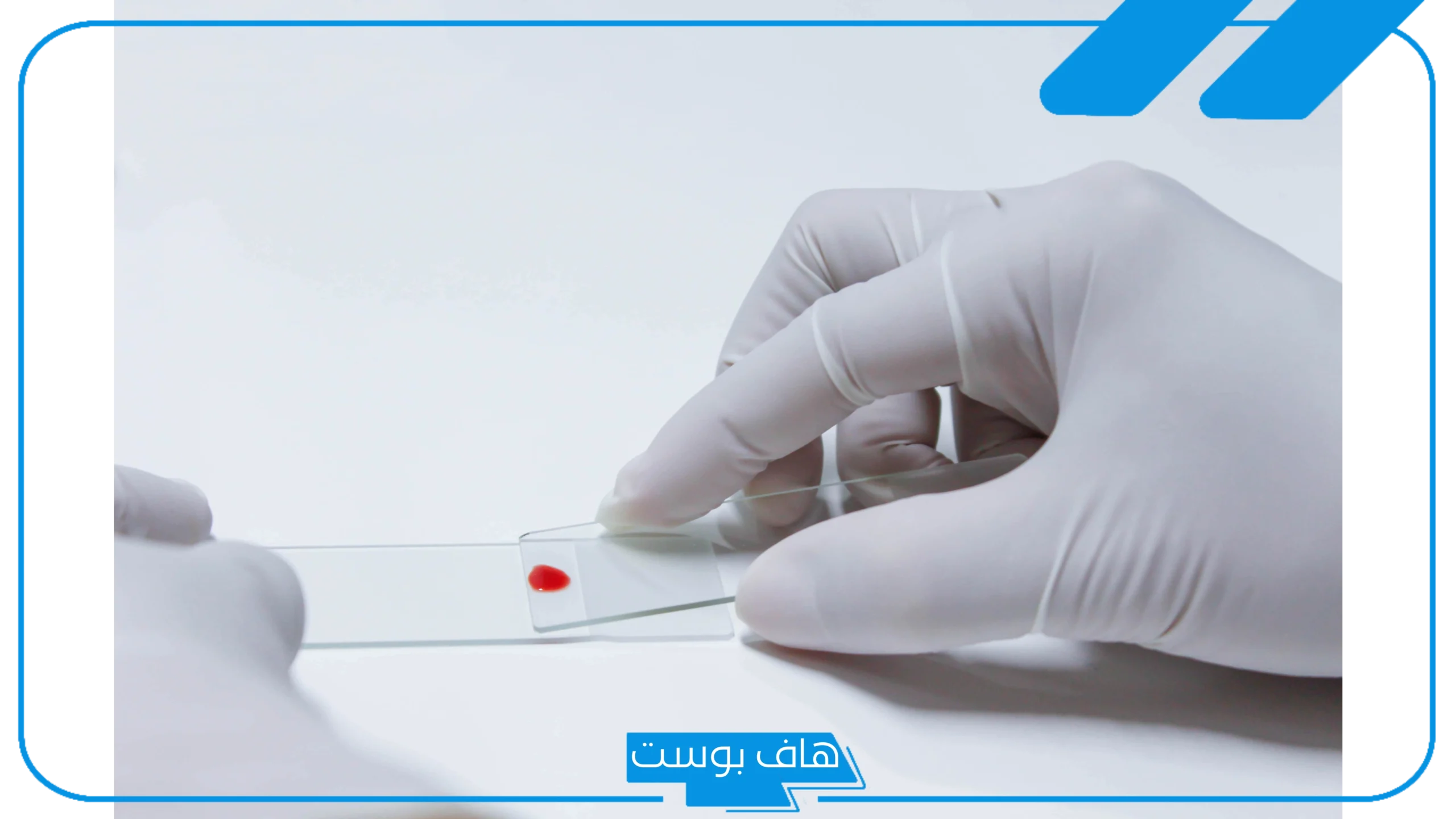 تفسير حلم الدم للعزباء والمتزوجة على الملابس في المنام لابن سيرين