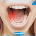 تفسير رؤية خلع الضرس في المنام للمتزوجة والعزباء لابن سيرين