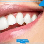تفسير حلم الاسنان الامامية متفرقة للمتزوجه والمطلقة والرجل لابن سيرين