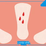 تفسير حلم نزول الدورة في المنام قبل موعدها للمتزوجه والحامل لابن سيرين
