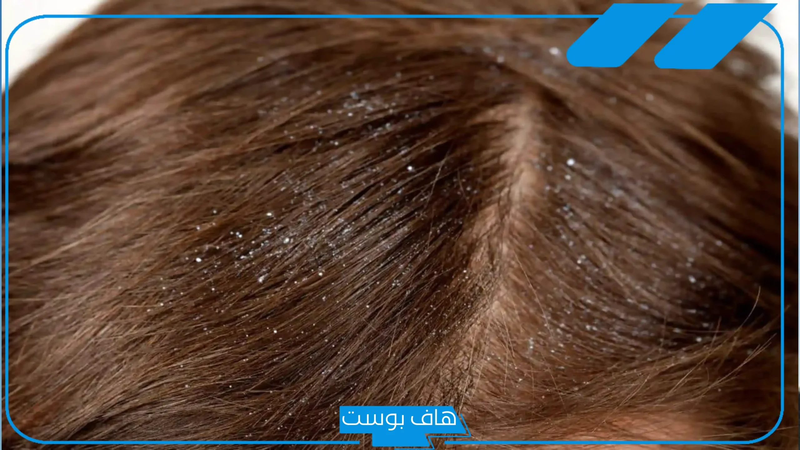 تفسير حلم الصيبان في الشعر وقتله في المنام للعالم ابن سيرين
