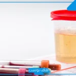 تفسير حلم تبول الدم في المنام لابن سيرين في المرحاض للعزباء