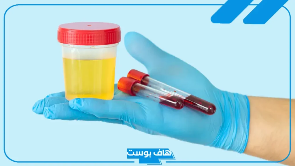 تفسير حلم البول وفيه دم في المنام للحامل والرجل لابن سيرين