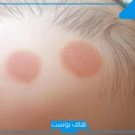 تفسير حلم رؤية الثعلبة في المنام لابن شاهين وابن سيرين