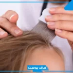 تفسير رؤية القمل في الشعر في المنام للمرأة المتزوجة لابن سيرين