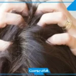 تفسير حلم اخراج القمل من الشعر في المنام وقتله لابن سيرين