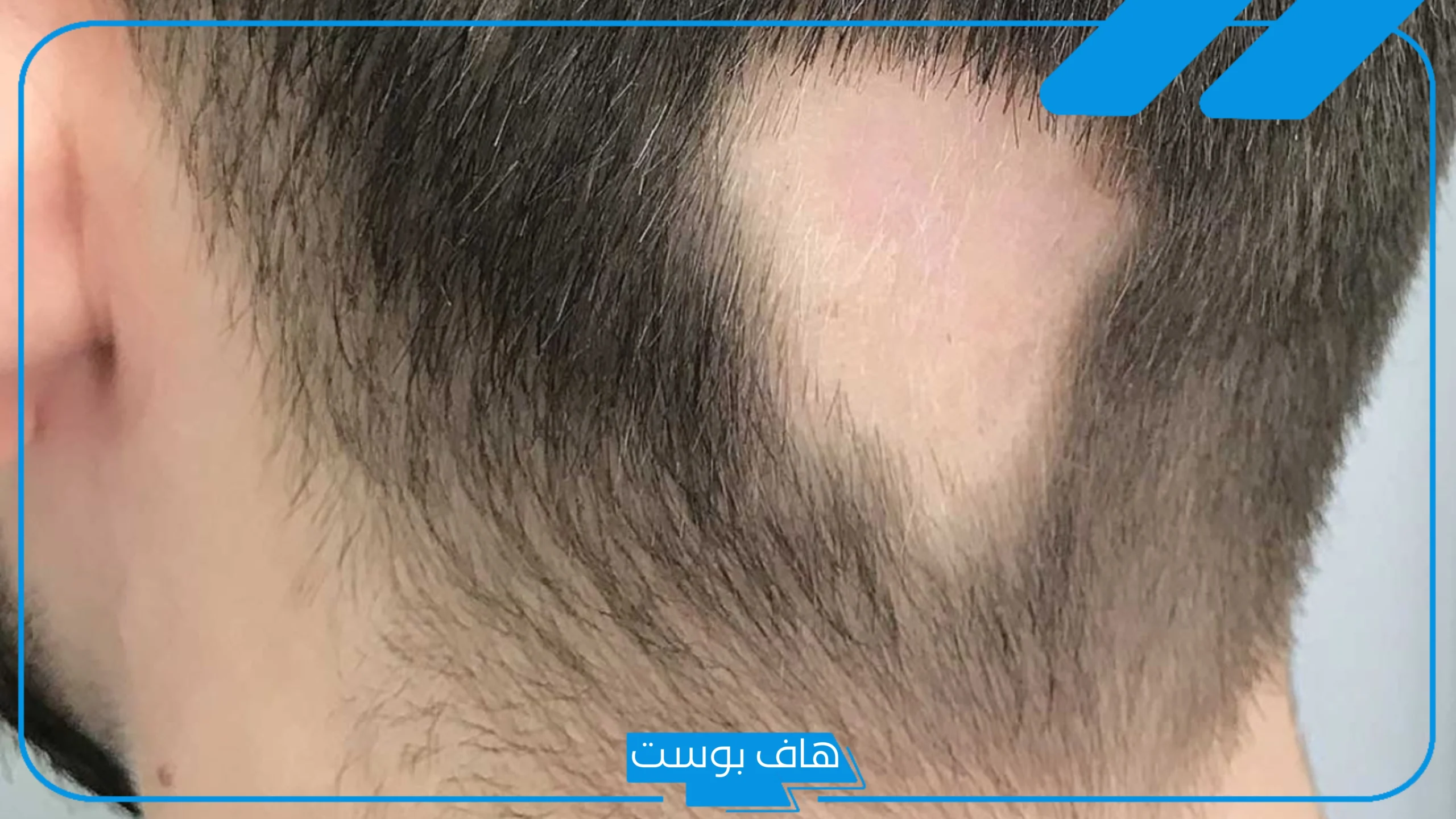 تفسير حلم رؤية الثعلبة في المنام لابن شاهين وابن سيرين