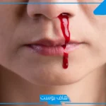 تفسير حلم نزيف الانف وخروج دم في المنام عند العالم ابن سيرين
