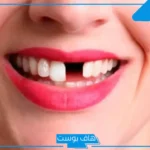 تفسير حلم سقوط الاسنان بدون دم للرجل والمتزوجة في المنام لابن سيرين