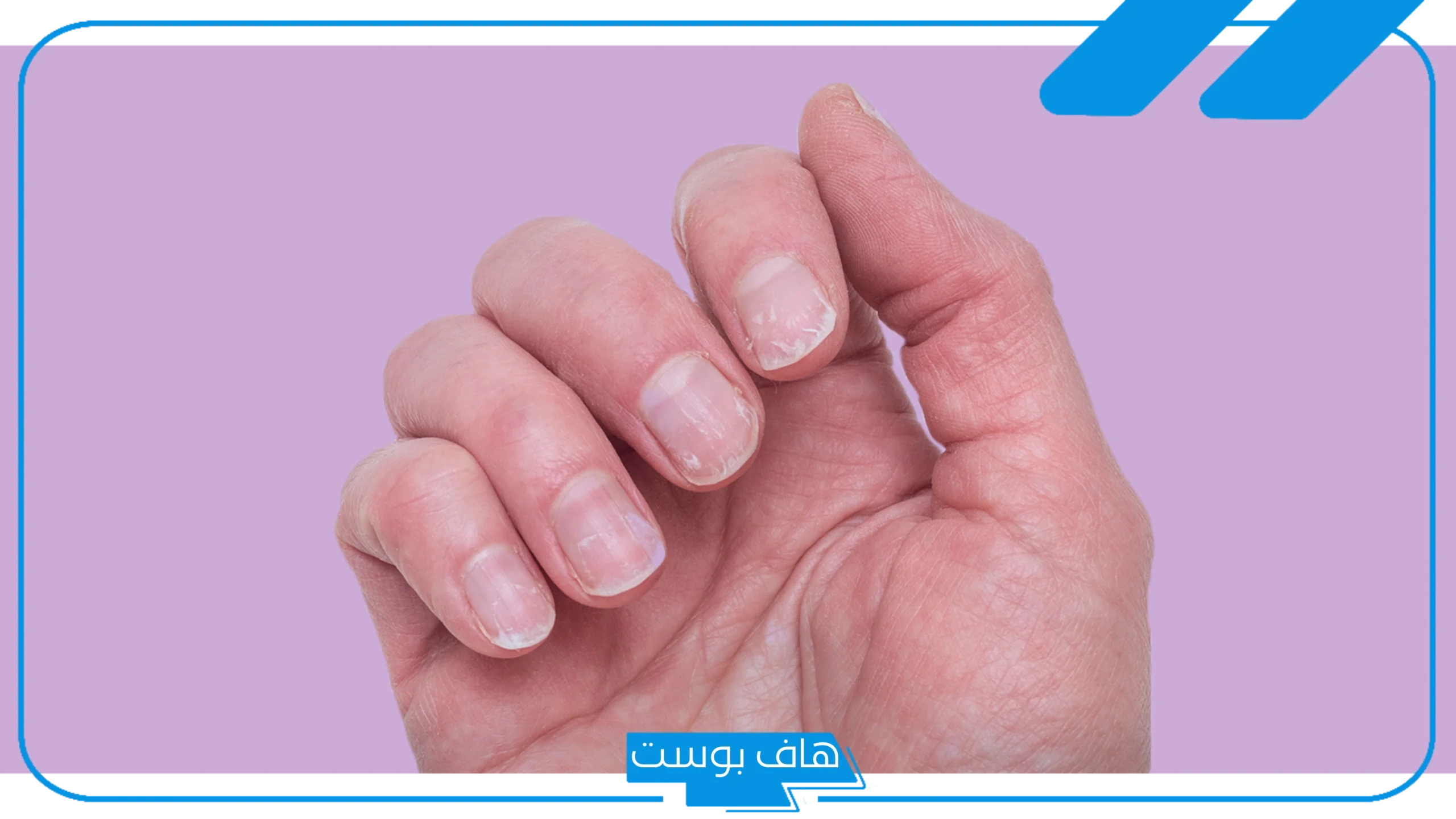 تفسير حلم الاظافر للعزباء في المنام وتركيبها وقصها لابن سيرين