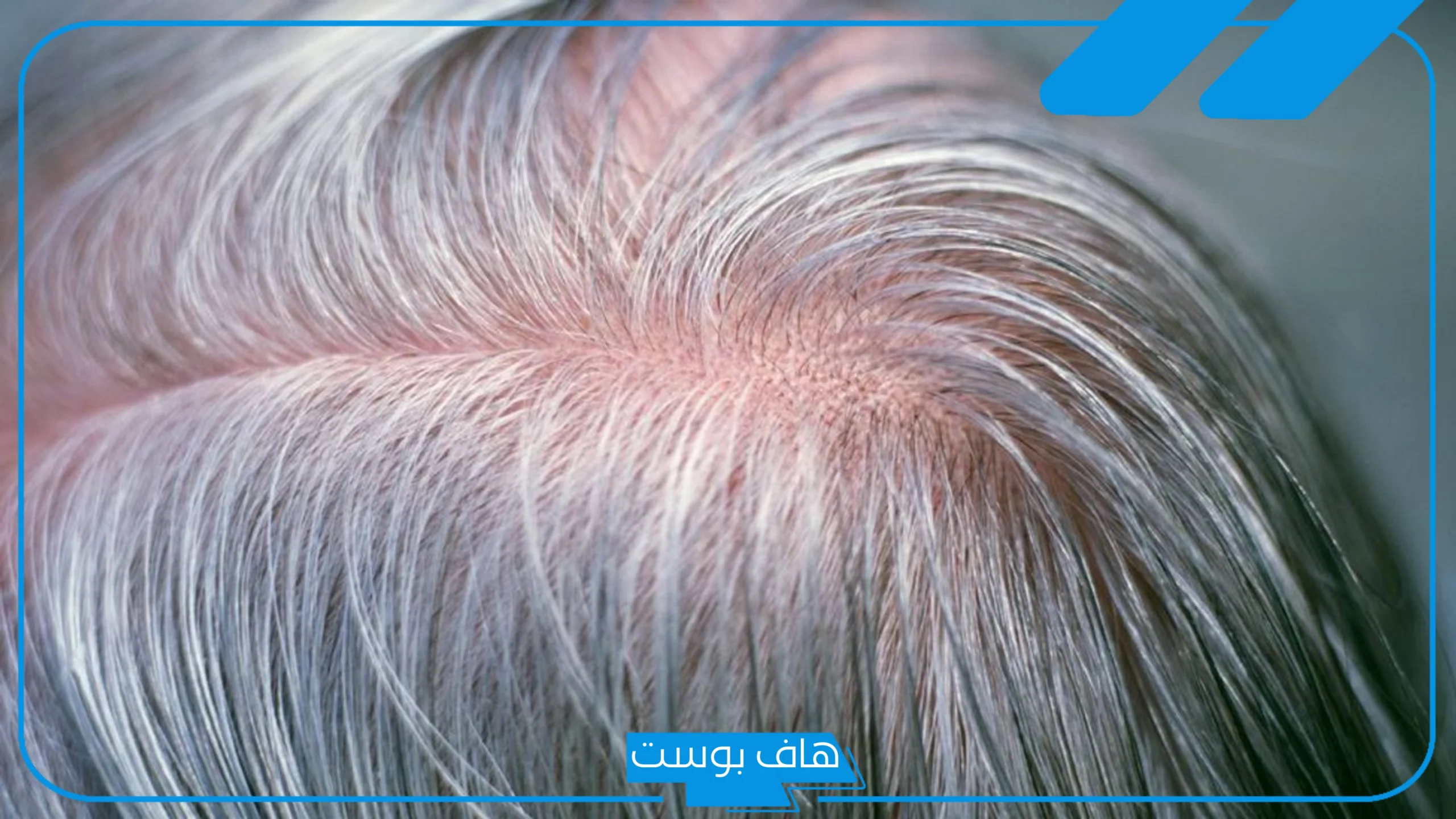 تفسير حلم الشعر الابيض في المنام لابن سيرين للمتزوجة والمرأة العزباء تفسير حلم الشعر الابيض في المنام لابن سيرين للمتزوجة والمرأة العزباء