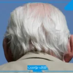 تفسير حلم الشعر الابيض في المنام لابن سيرين للمتزوجة والمرأة العزباء