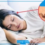 تفسير حلم العقرب الصفراء في المنام لابن سيرين وقتلها للمرأة العزباء