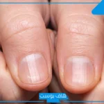 تفسير حلم الظفر في المنام وخلعه للمتزوجة والعزباء لابن سيرين