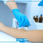 تجربتي مع الفصد لعلاج عرق النسا.. مخاطر الفصد