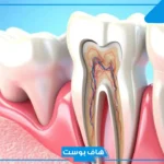 تفسير رؤية سقوط الضرس في المنام للمتزوجة والعزباء لابن سيرين 
